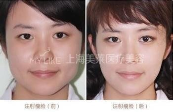 整形有底线,不要太任性!