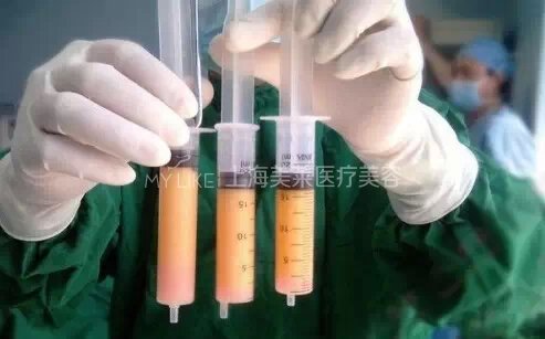 整形有底线,不要太任性!