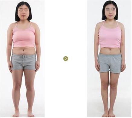 夏季快速减肥的方法吸脂吗?