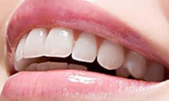 坑爹!父母不帮孩子矫正牙齿会被起诉