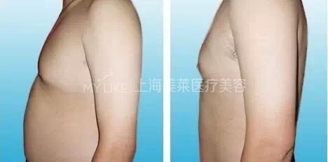 男性整形,不可忽略的潜力阵地!